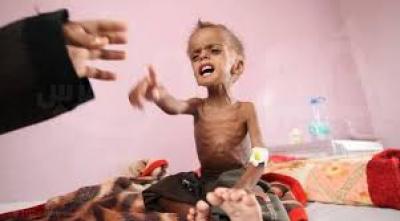 احصائيات لانتهاكات العدوان بحق أطفال اليمن طوال 1700 يوم	 