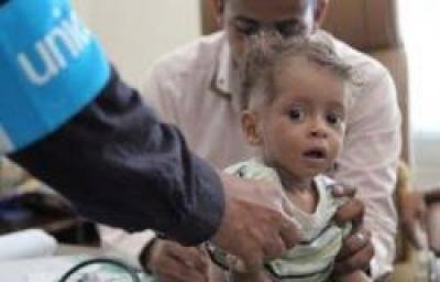 الأمم المتحدة.. إغلاق 26 برنامجا في اليمن ومليونا طفل بحاجة لعلاج من سوء التغذية	 