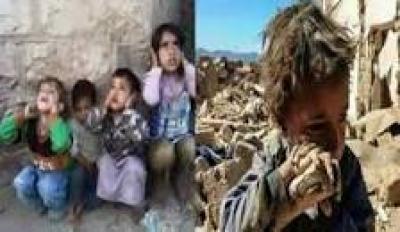  - الاضرار النفسية للعدوان السعودي والحرب على اطفال اليمن..
